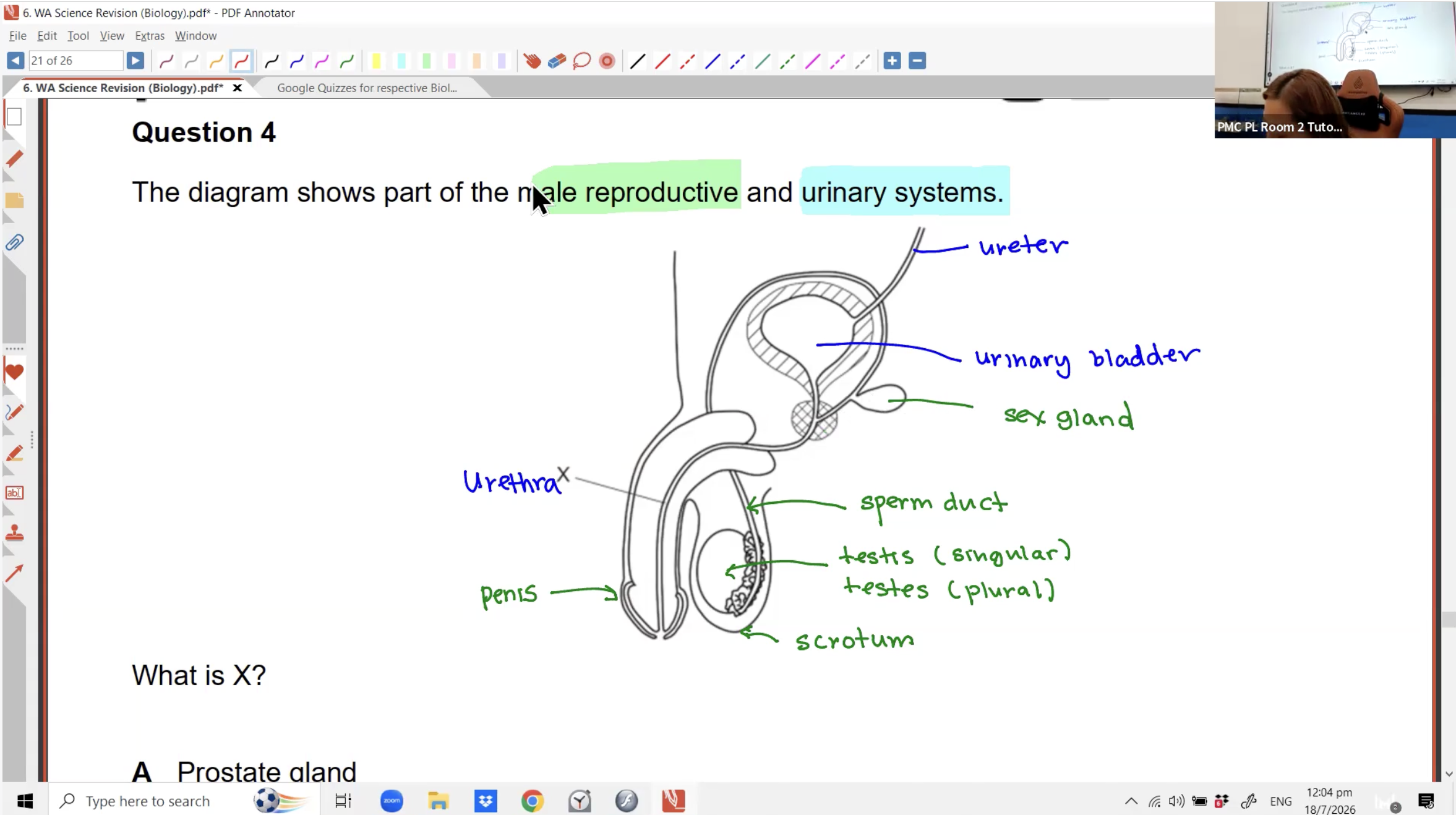 31. [BIO] WA Revision [2026] - Ms JL
